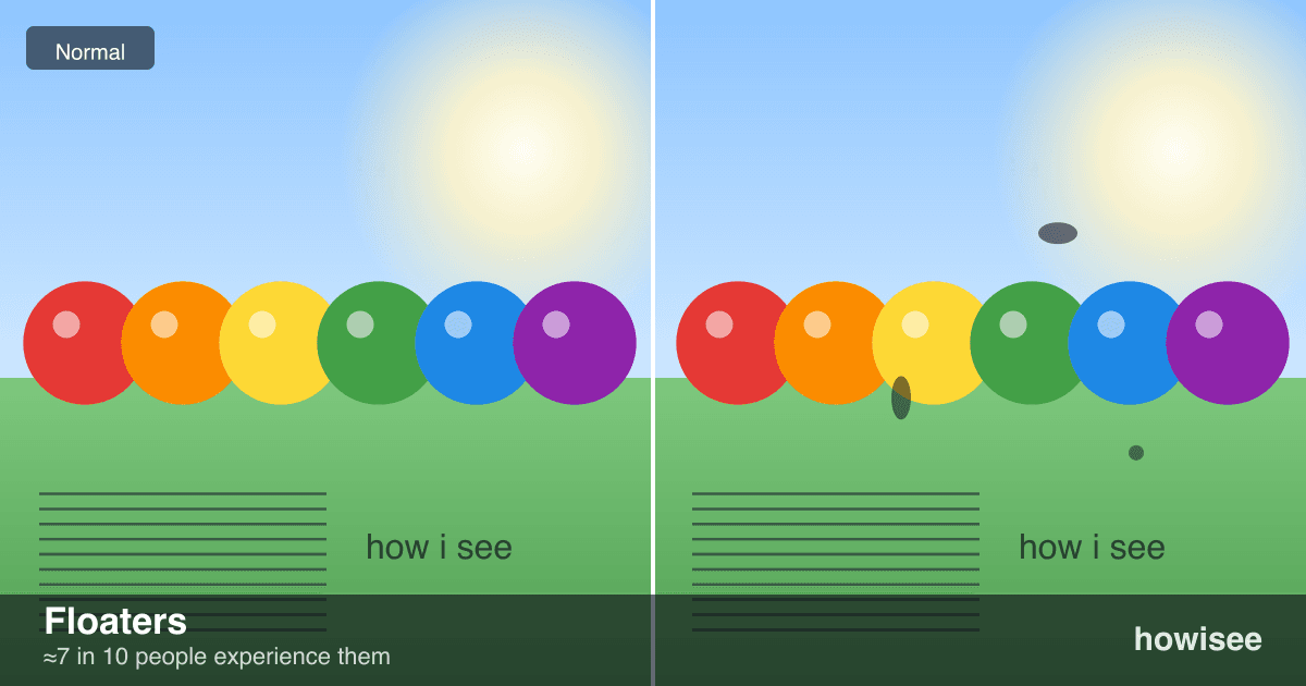 A before/after showing Floaters: a normal scene on the left, the same scene as seen with Floaters on the right