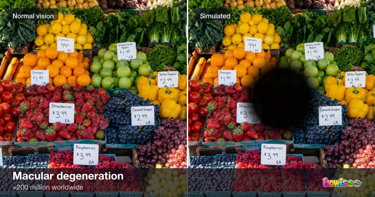 A before/after showing Macular degeneration: a normal scene on the left, the same scene as seen with Macular degeneration on the right