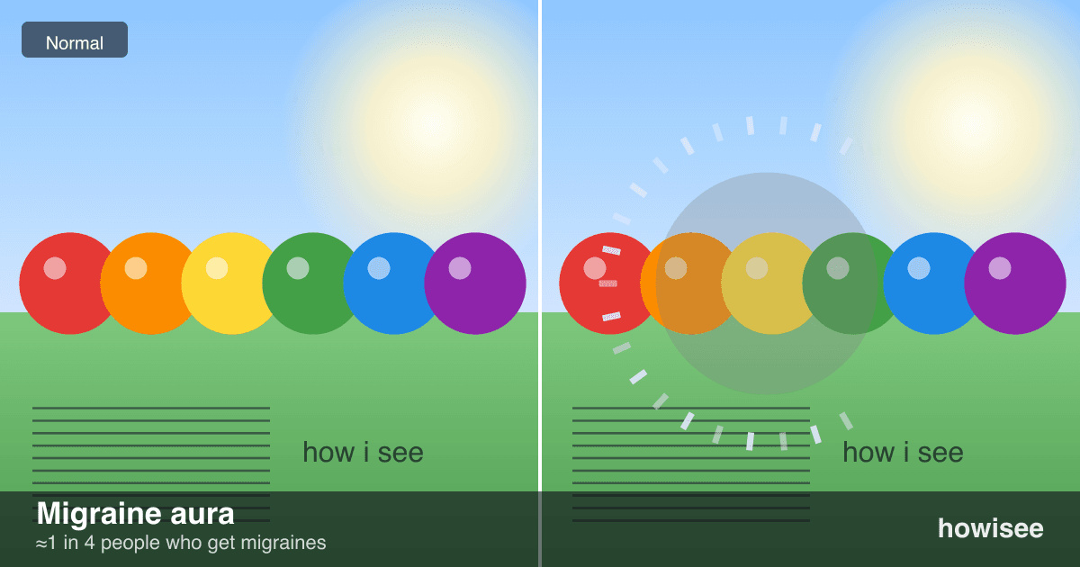 A before/after showing Migraine aura: a normal scene on the left, the same scene as seen with Migraine aura on the right