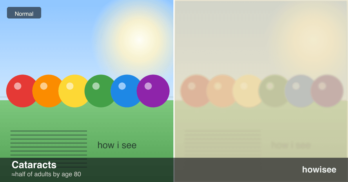 A before/after showing Cataracts: a normal scene on the left, the same scene as seen with Cataracts on the right