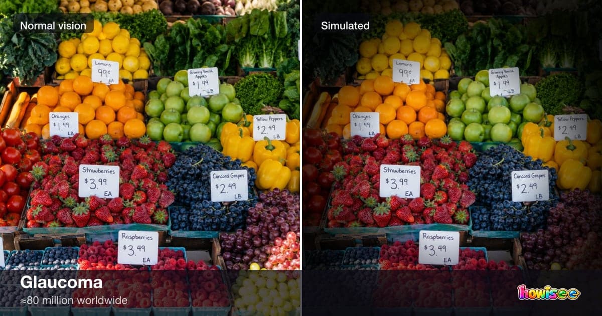 A before/after showing Glaucoma: a normal scene on the left, the same scene as seen with Glaucoma on the right