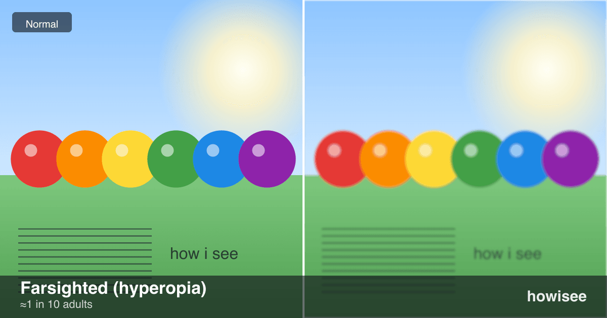 A before/after showing Farsighted (hyperopia): a normal scene on the left, the same scene as seen with Farsighted (hyperopia) on the right