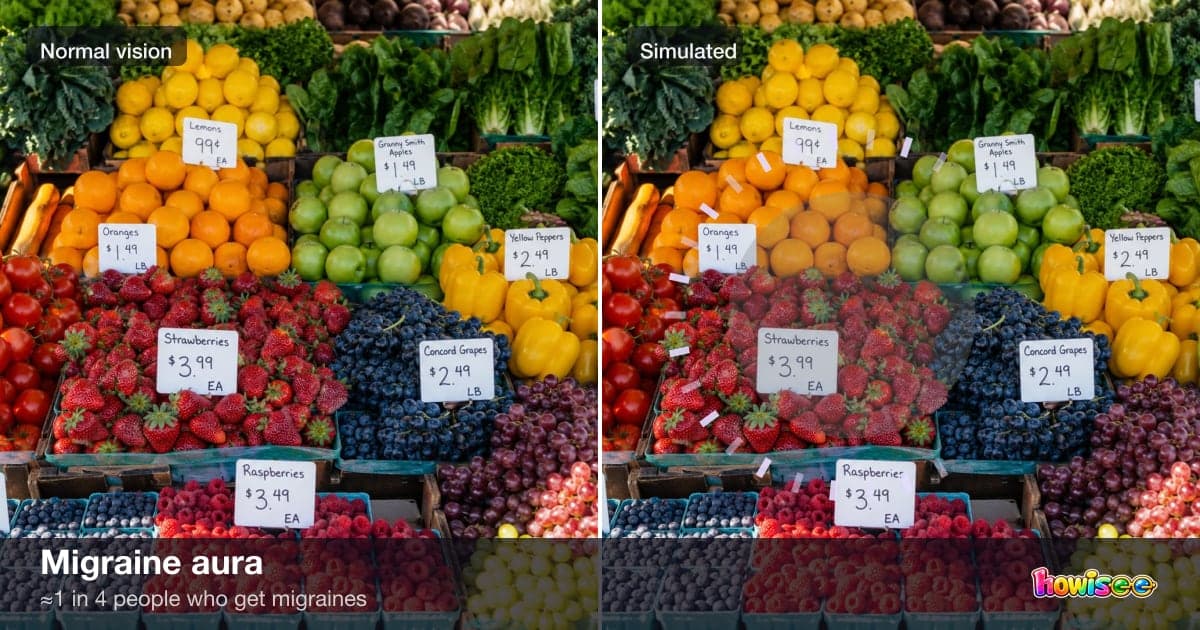 A before/after showing Migraine aura: a normal scene on the left, the same scene as seen with Migraine aura on the right