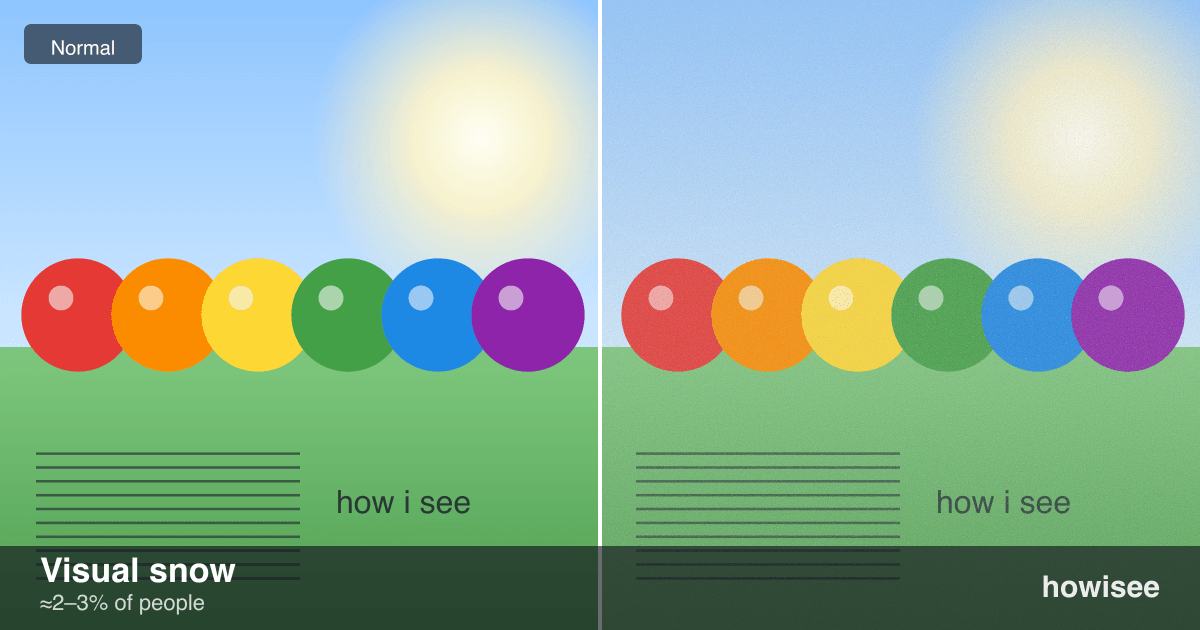 A before/after showing Visual snow: a normal scene on the left, the same scene as seen with Visual snow on the right